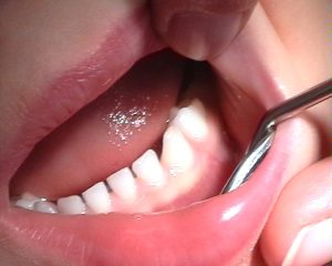 مشکلات دندانی 3