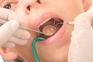 مشکلات دندانی 1
