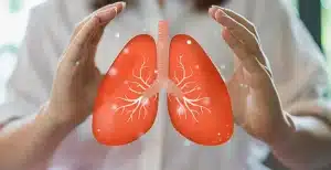 هایپرکاپنه